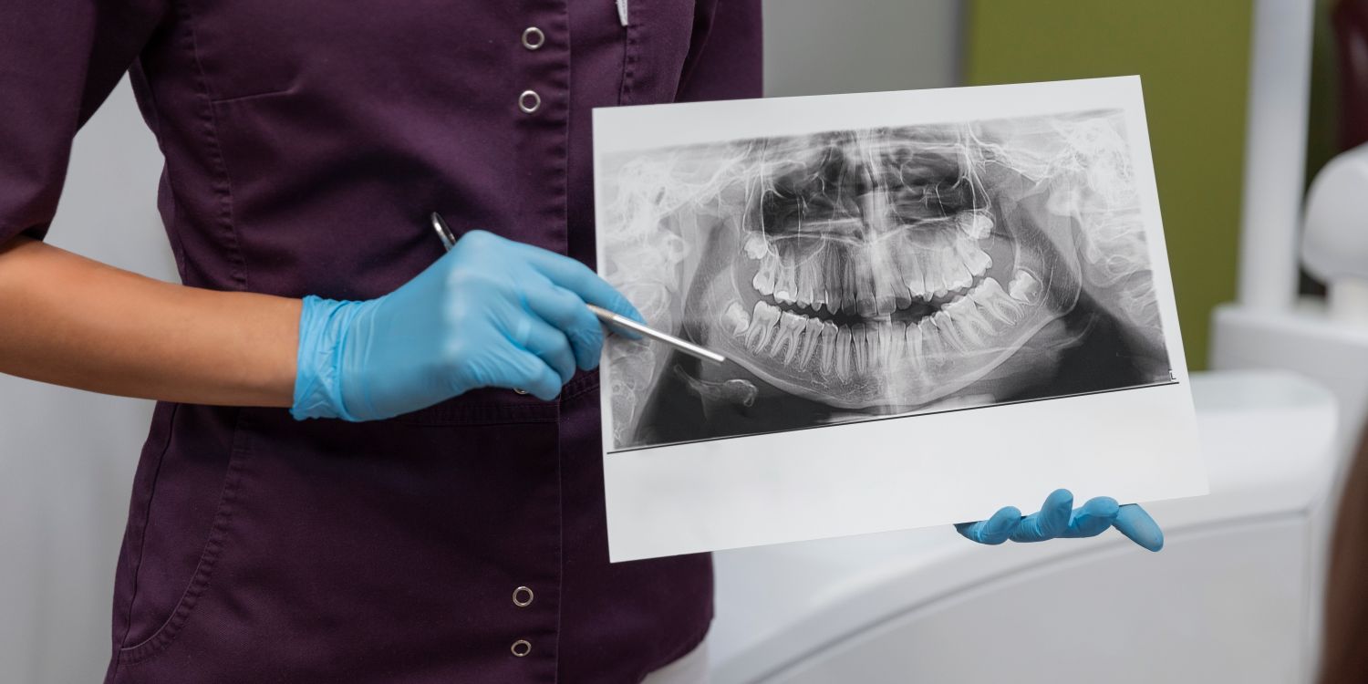X-Ray Machine for Sale – Financing & Leasing for Dentists in 2024